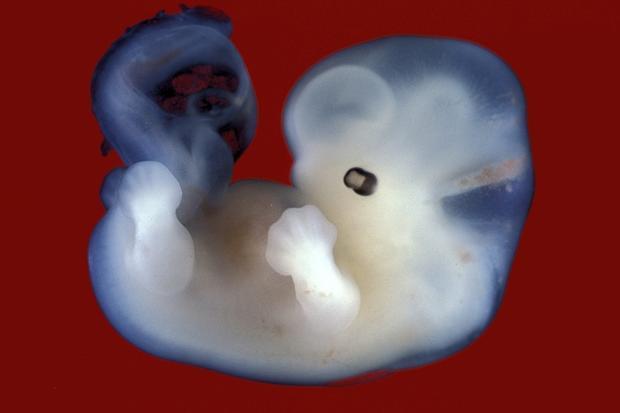 fertility treatment