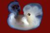 fertility treatment