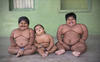 Obese Children UNA