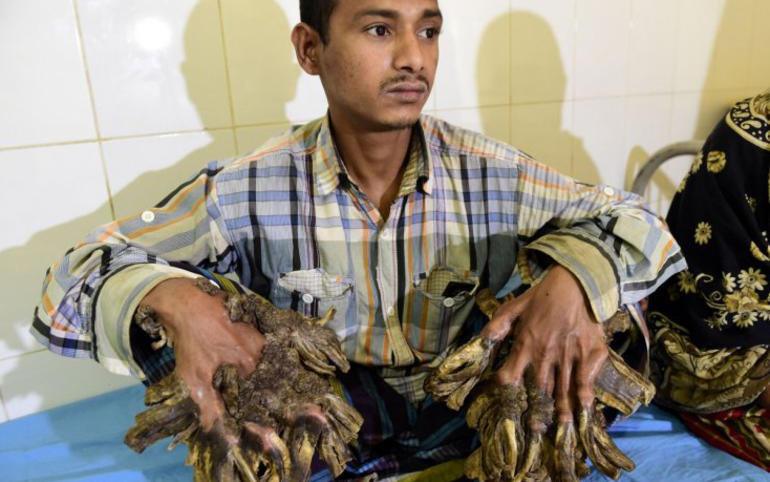 માણસના હાથ પગ વૃક્ષની ડાળીઓમા