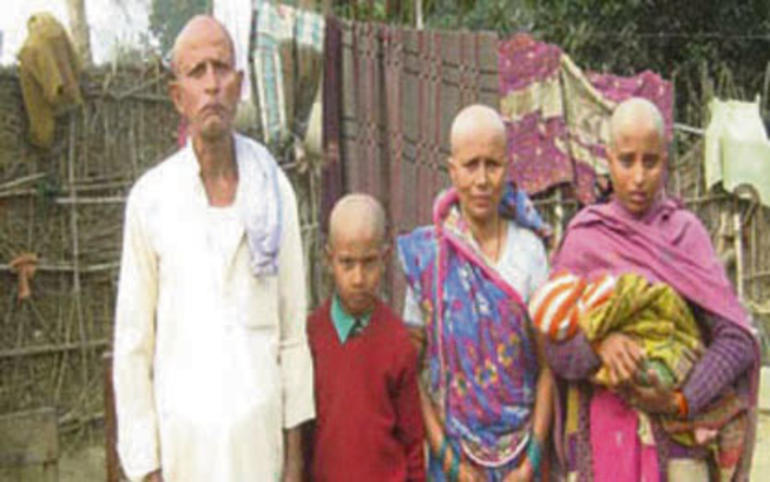હેન્ડ પમ્પના પાણીથી સ્નાન કર્