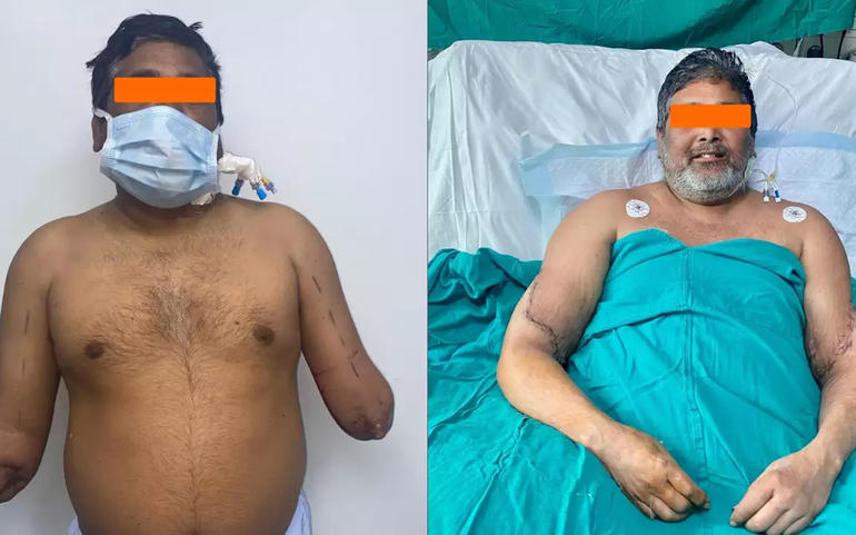 ભારતીય તબીબોની કમાલઃ દિલ્હીન ભારતીય તબીબોની કમાલઃ દિલ્હીન
