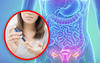 pcos