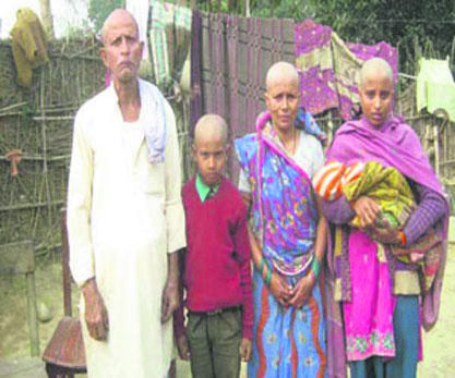Bald Family