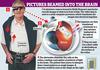 Bionic eye