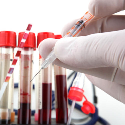 Blood Test-Heart