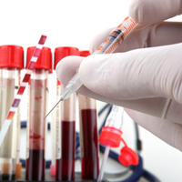 Blood Test-Heart Blood Test-Heart