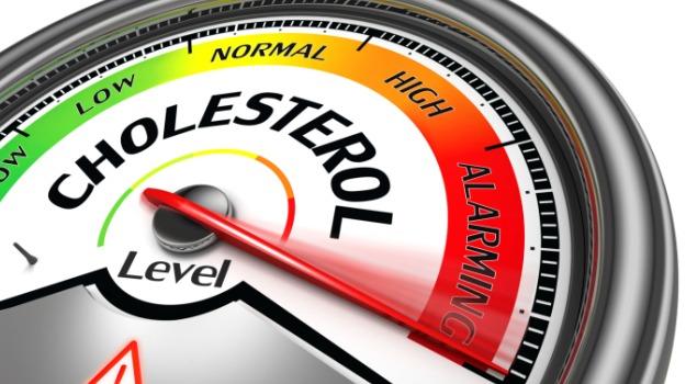 Cholesterol