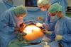 Gastric band surgery