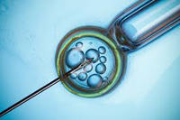 IVF Technique copy IVF Technique copy
