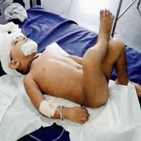Railway Accident boy