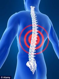 Spinal Discs Spinal Discs