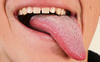 Tongue